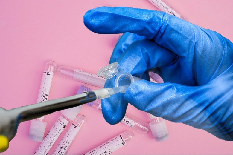 Quali sono i servizi offerti dal laboratorio analisi Via Pasubio