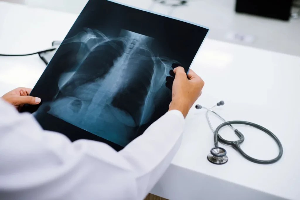 Dove posso trovare servizi di radiografia a Catania 4 Dove posso trovare servizi di radiografia a Catania